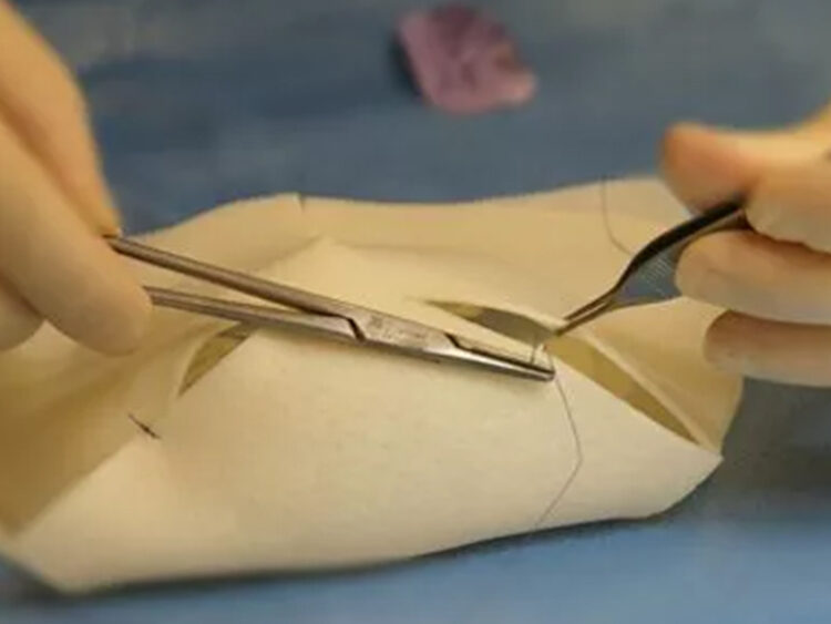 Braxon - Leap Biosurgical